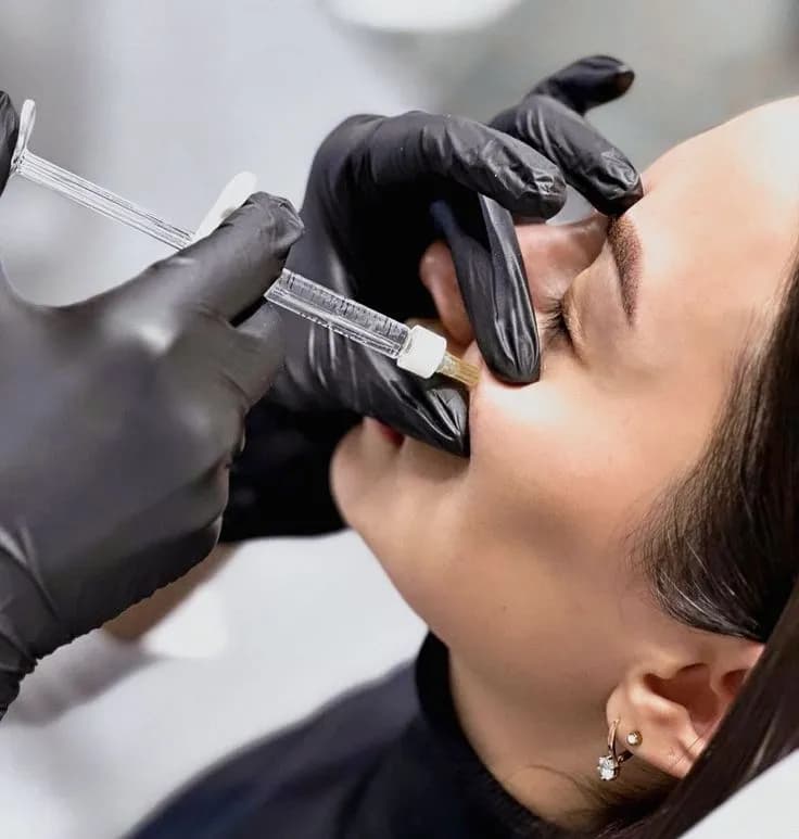 Dermal Fillers
